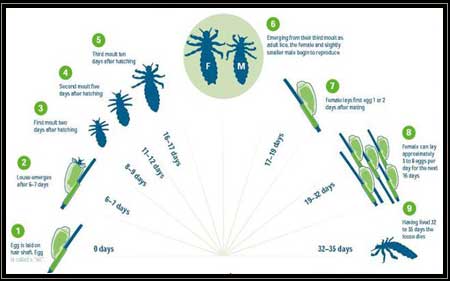 Head Lice | Faces Cosmetic Lasers Center