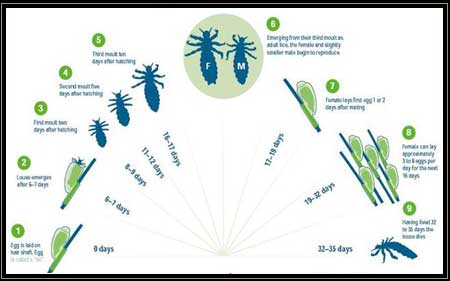 Head Lice