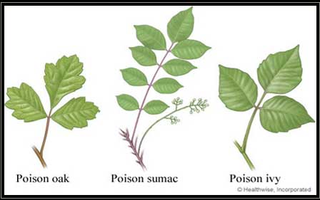 Poison Ivy Poison Oak Poison Sumac Faces Cosmetic Las - vrogue.co